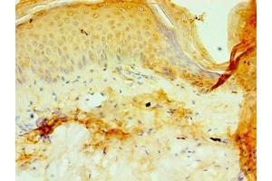 Immunohistochemistry of paraffin-embedded human skin tissue using ABIN7164787 at dilution of 1:100 (P4HA3 antibody  (AA 20-544))