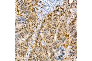 Immunohistochemistry (IHC) image for anti-Yes-Associated Protein 1 (YAP1) antibody (ABIN7271418)