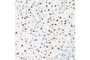 Immunohistochemistry of paraffin-embedded rat ovary using SUPT5H/SPT5 Rabbit mAb (ABIN7270878) at dilution of 1:100 (40x lens). (SUPT5H antibody)