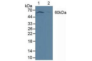 Figure. (PDPK1 antibody  (AA 83-338))