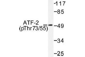 Image no. 1 for anti-Activating Transcription Factor 2 (ATF2) (pThr55), (pThr73) antibody (ABIN317967) (ATF2 antibody  (pThr55, pThr73))