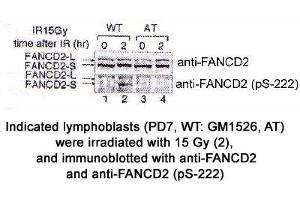Image no. 1 for anti-Fanconi Anemia, Complementation Group D2 (FANCD2) (AA 217-226), (pSer222) antibody (ABIN363448) (FANCD2 antibody  (pSer222))