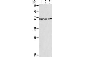 Gel: 8 % SDS-PAGE, Lysate: 40 μg, Lane 1-3: PC3 cells, hela cells, A549 cells, Primary antibody: ABIN7191485(MMP23B Antibody) at dilution 1/200, Secondary antibody: Goat anti rabbit IgG at 1/8000 dilution, Exposure time: 10 seconds (MMP23A antibody)