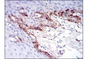 Immunohistochemical analysis of paraffin-embedded esophageal tissues using FTL mouse mAb with DAB staining. (FTL antibody  (AA 1-157))