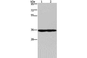 Western Blot analysis of Mouse heart and kidney tissue using NDUFA9 Polyclonal Antibody at dilution of 1:400 (NDUFA9 antibody)