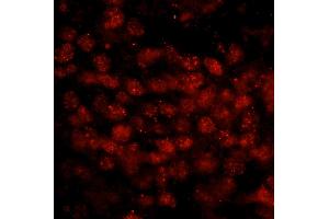 Immunofluorescence (IF) image for anti-Wilms Tumor 1 Associated Protein (WTAP) (AA 346-396) antibody (ABIN7449036) (WTAP antibody  (AA 346-396))