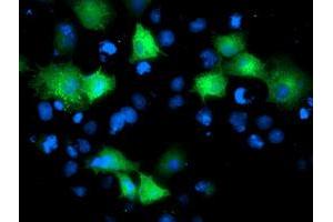 Anti-ARFGAP1 mouse monoclonal antibody (ABIN2454386) immunofluorescent staining of COS7 cells transiently transfected by pCMV6-ENTRY ARFGAP1 (RC206987). (ARFGAP1 antibody)