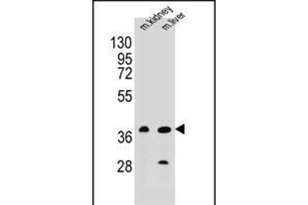 CELF6 Antikörper  (N-Term)