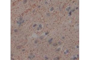 Figure. (FKBP10 antibody  (AA 158-440))