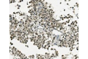 IHC analysis of REC8 using anti-REC8 antibody (ABIN7599473). (REC8 antibody  (AA 1-547))