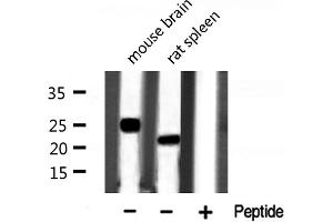 Western blot analysis of RASH/RASK/RASN expression in various lysates (RASH/RASK/RASN antibody)