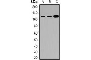 Western blot analysis of Tensin 3 expression in HeLa (A), DLD (B), H9C2 (C) whole cell lysates. (TNS3 antibody)