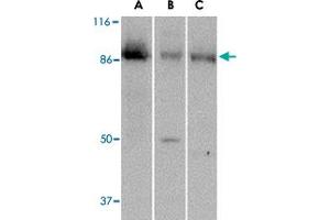 Western blot analysis of PTK7 in (A) human colon, (B) mouse kidney and (C) rat liver tissue lysate with PTK7 polyclonal antibody  at 1 ug/mL . (PTK7 antibody  (C-Term))