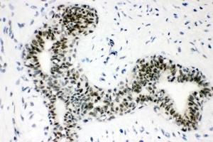 IHC analysis of Sumo 1/SUMO1 using anti-Sumo 1/SUMO1 antibody (ABIN7603002).