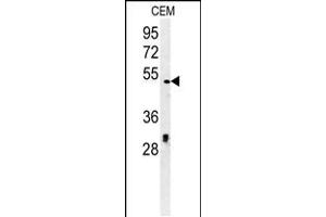 Western blot analysis in CEM cell line lysates (35ug/lane). (DSCC1 antibody  (C-Term))