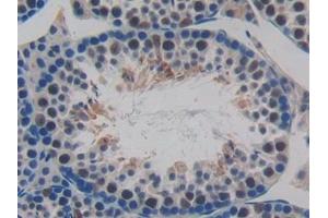 Detection of MCP2 in Mouse Testis Tissue using Polyclonal Antibody to Monocyte Chemotactic Protein 2 (MCP2) (CCL8 antibody  (AA 20-94))