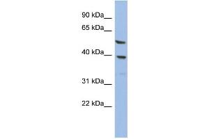 WB Suggested Anti-OLAH Antibody Titration: 0. (OLAH antibody  (N-Term))