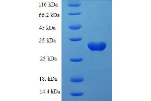 SDS-PAGE (SDS) image for Sortilin 1 (SORT1) (AA 610-754) protein (His-SUMO Tag) (ABIN5710402)