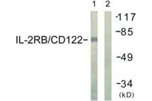 Western blot analysis of extracts from COS7 cells, using IL-2R beta/CD122 (Ab-364) Antibody.
