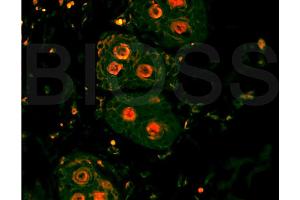 Formalin-fixed and paraffin-embedded rat skin labeled with Anti-? (beta Catenin antibody  (AA 661-781))