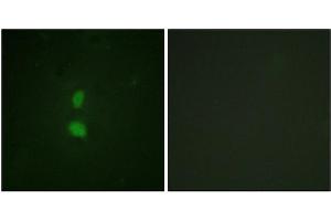 Immunofluorescence (IF) image for anti-SNAIL (SNAI1) (pSer246) antibody (ABIN7138508)