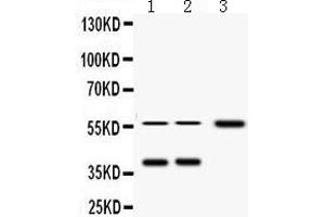 Western Blotting (WB) image for anti-alpha-2-HS-Glycoprotein (AHSG) (AA 33-65), (N-Term) antibody (ABIN3043534) (Fetuin A antibody  (N-Term))