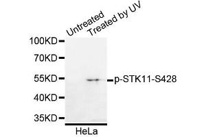 Western blot analysis of extracts of HeLa cells, using Phospho-STK11-S428 antibody (ABIN5995629). (LKB1 antibody  (pSer428))