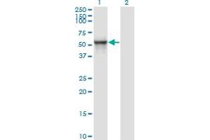Western Blot analysis of ITFG2 expression in transfected 293T cell line by MDS028 monoclonal antibody (M01), clone 1A8. (ITFG2 antibody  (AA 1-447))