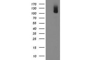 Western Blotting (WB) image for anti-phosphodiesterase 2A, CGMP-Stimulated (PDE2A) antibody (ABIN1500082) (PDE2A antibody)