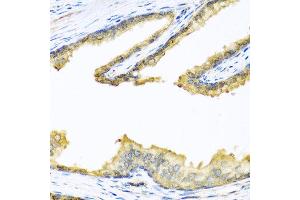 Immunohistochemistry of paraffin-embedded human prostate using PENK antibody at dilution of 1:100 (40x lens). (Enkephalin antibody)