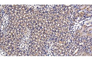 Immunohistochemistry (IHC) image for anti-Nuclear Factor-kB p65 (NFkBP65) (AA 19-306) antibody (ABIN7432211)