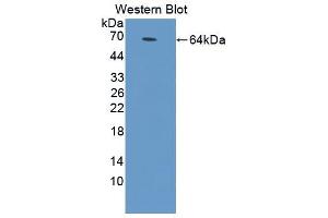 Western blot analysis of the recombinant protein. (MYD88 antibody  (AA 1-296))