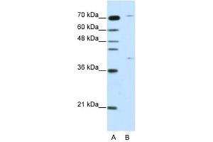 ZNF668 antibody (20R-1224) used at 0. (ZNF668 antibody  (C-Term))