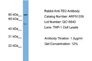WB Suggested Anti-TEC  Antibody Titration: 0. (NR4A3 antibody  (Middle Region))
