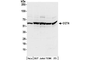 anti-Chaperonin Containing TCP1, Subunit 4 (Delta) (CCT4) (AA 489-539) antibody