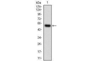 Western blot analysis using HDAC10 mAb against human HDAC10 (AA: 18-219) recombinant protein. (HDAC10 antibody  (AA 18-219))