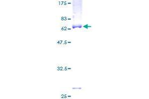 Image no. 1 for ST6 (Alpha-N-Acetyl-Neuraminyl-2,3-beta-Galactosyl-1,3)-N-Acetylgalactosaminide alpha-2,6-Sialyltransferase 6 (ST6GALNAC6) (AA 1-333) protein (GST tag) (ABIN1321513) (ST6GALNAC6 Protein (AA 1-333) (GST tag))