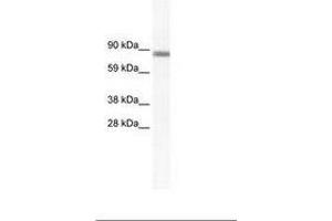 Image no. 1 for anti-GATA Zinc Finger Domain Containing 2A (GATAD2A) (N-Term) antibody (ABIN202841) (GATAD2A antibody  (N-Term))