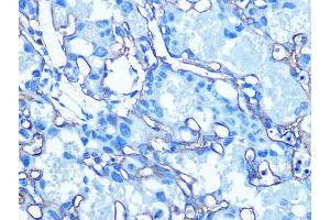 Immunohistochemistry of paraffin-embedded Mouse placenta using GLUT1/SLC2 antibody (ABIN6129475, ABIN6147954, ABIN6147956 and ABIN6222743) at dilution of 1:100 (40x lens). (GLUT1 antibody  (AA 210-310))