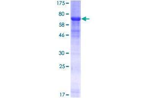 Image no. 1 for Ras-Related GTP Binding C (RRAGC) (AA 1-399) protein (GST tag) (ABIN1318886) (GTR2 Protein (AA 1-399) (GST tag))