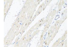 Immunohistochemistry of paraffin-embedded rat heart using RBFOX3 antibody (ABIN1874561) at dilution of 1:100 (40x lens). (NeuN antibody)