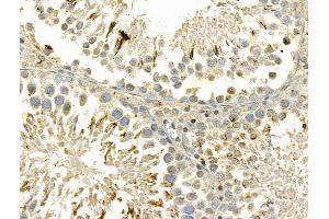 ABIN6261297 and ABIN6273041 at 1/100 staining Rat testis tissue by IHC-P. (DIAPH3 antibody  (Internal Region))