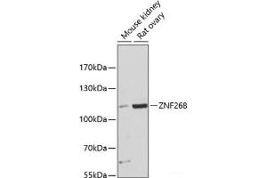 Western blot analysis of extracts of various cell lines using ZNF268 Polyclonal Antibody at dilution of 1:3000.