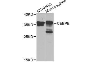 Western blot analysis of extracts of various cell lines, using CEBPE antibody (ABIN5975692) at 1/1000 dilution. (CEBPE antibody)
