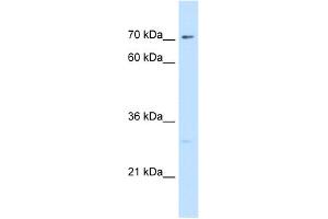 WB Suggested Antibody Titration:  5. (CTP Synthase antibody  (N-Term))