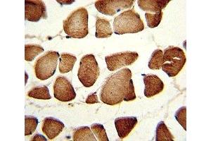 IHC analysis of FFPE human skeletal muscle stained with NAMPT antibody (NAMPT antibody  (AA 400-426))