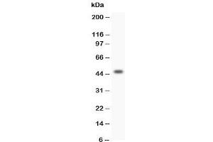 Western blot testing of HOXA3 antibody and SW620 lysate (HOXA3 antibody  (C-Term))