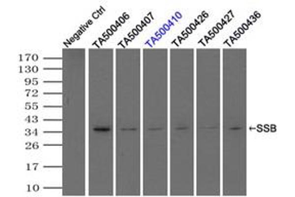 SSB antibody
