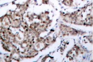 Image no. 1 for anti-BCL2-Associated Agonist of Cell Death (BAD) (pSer118), (pSer155) antibody (ABIN317970) (BAD antibody  (pSer118, pSer155))