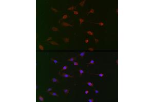 Immunofluorescence analysis of BALB-3T3 cells using CDC34 Rabbit pAb (ABIN6131558, ABIN6138257, ABIN6138258 and ABIN6221114) at dilution of 1:100 (40x lens).